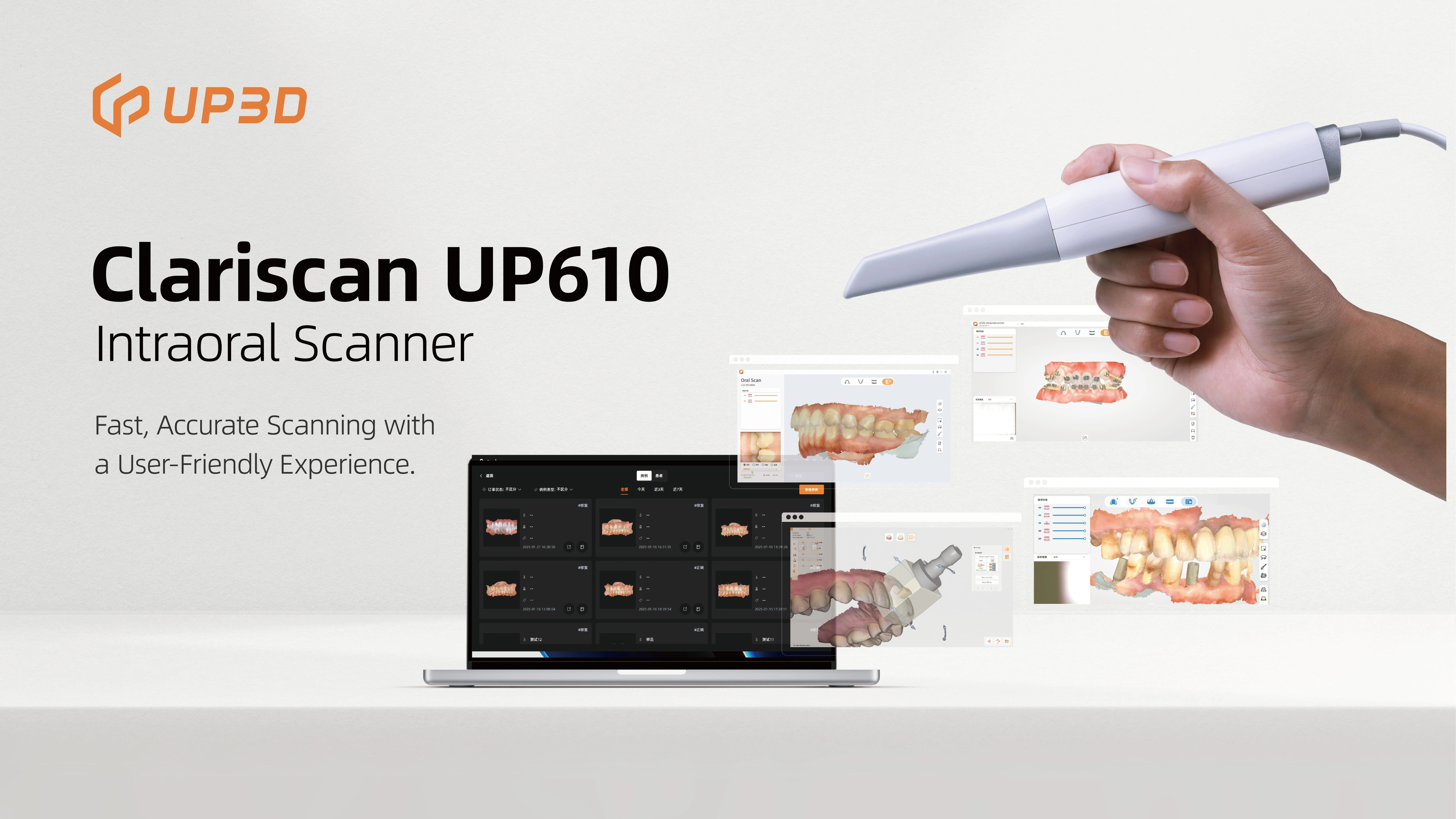 UP3D UP610 intraoral scanner with multiple clinical applications for dental workflows