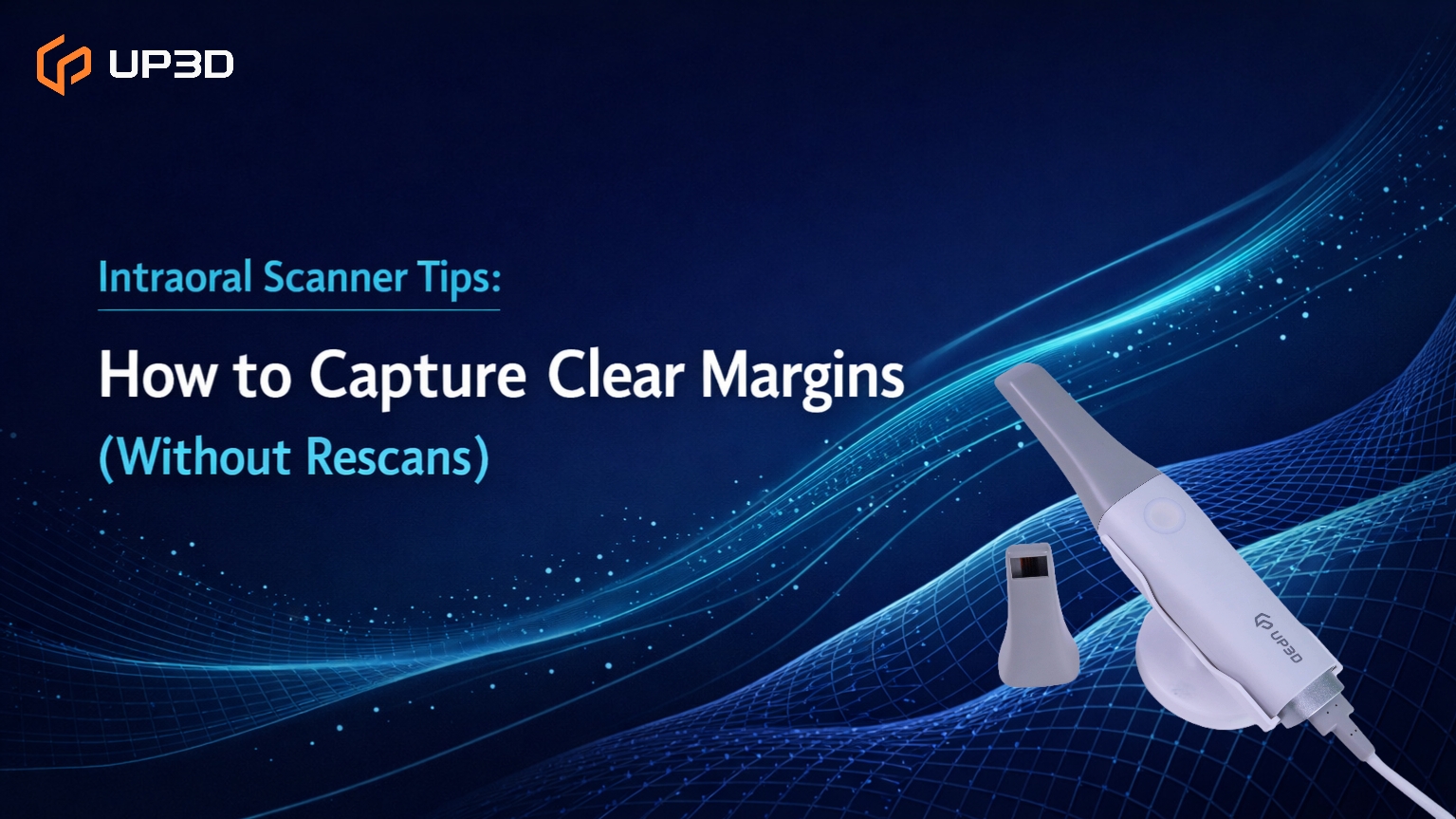 UP3D intraoral scanner tips cover image: capture clear margins without rescans