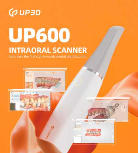 Dentist using UP600 intraoral scanner with one-touch button for easy scanning