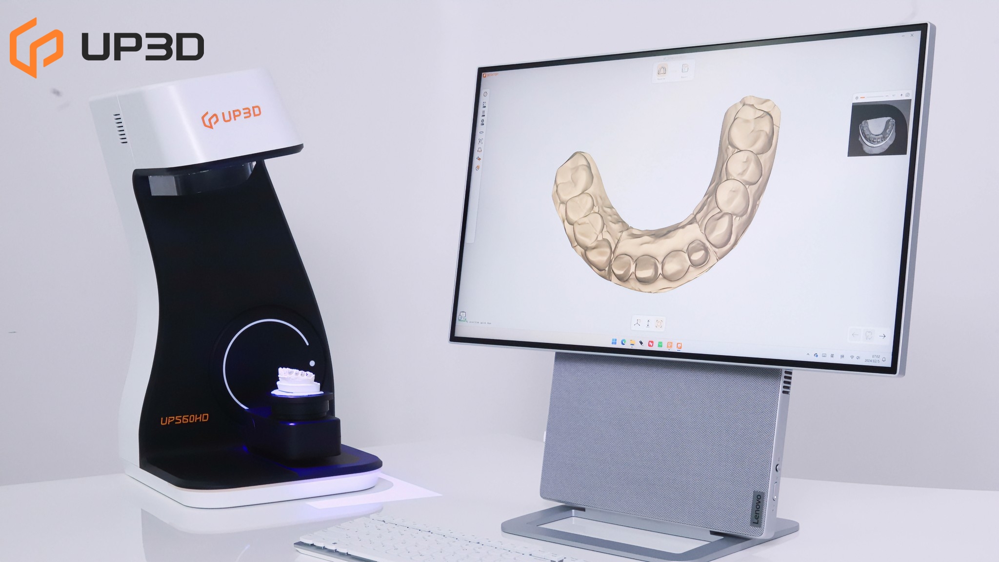 UP3D UP560HD high-precision dental scanner with 3D model displayed on screen for lab workflows