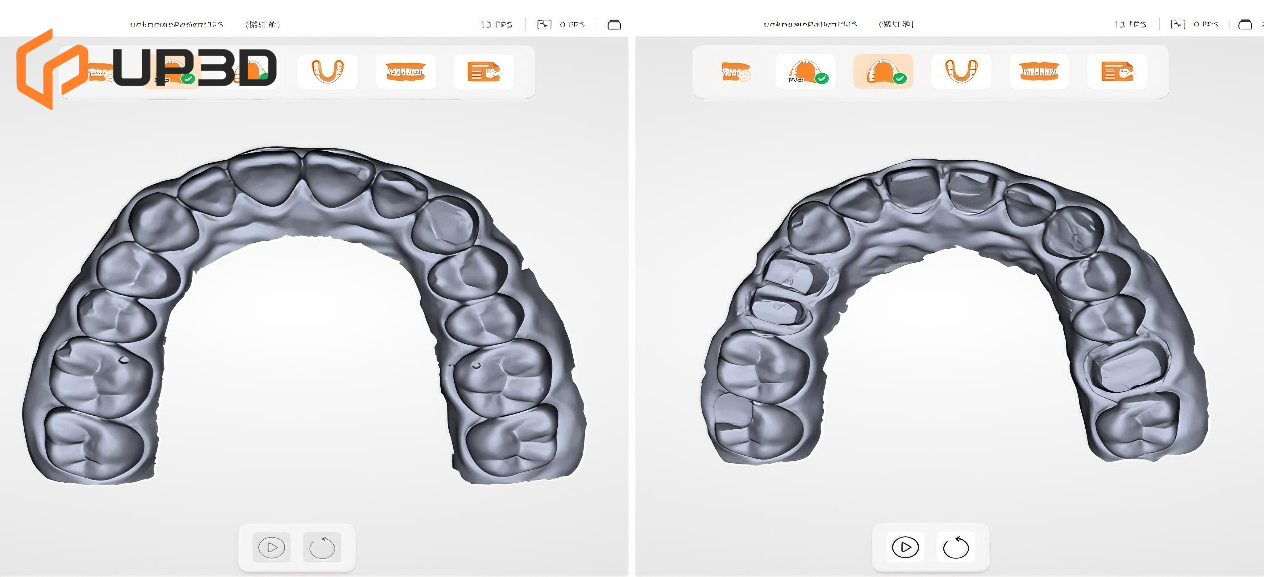 Digital dental impressions showing intraoral scan models for accurate CAD/CAM workflow