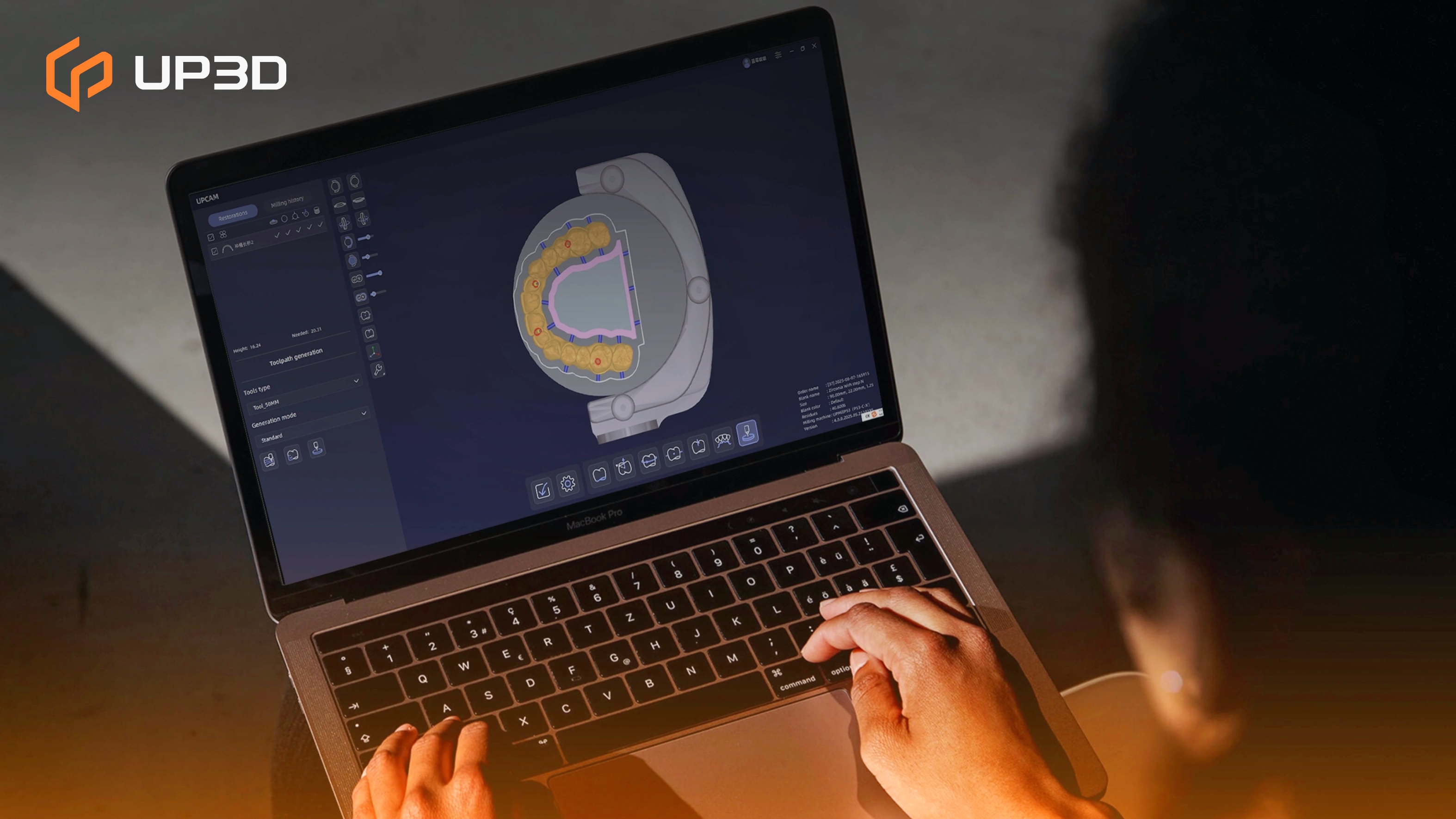 A dental technician using UP3D CAD/CAM software on a laptop to design a dental restoration and plan milling paths for the lab.