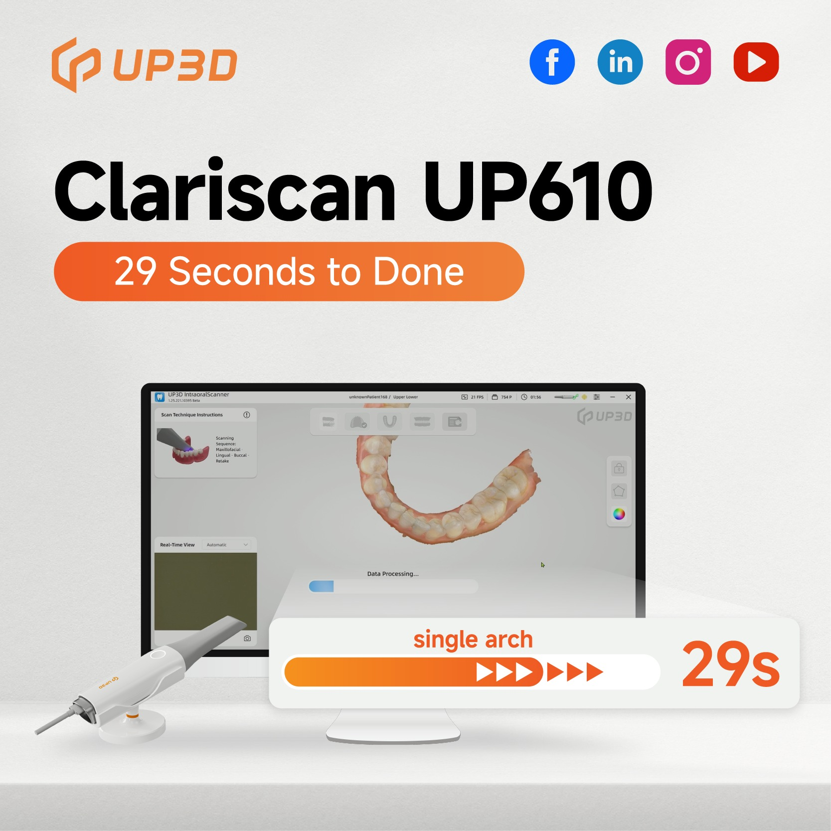 UP3D UP610 intraoral scanner completing single arch scan in 29 seconds