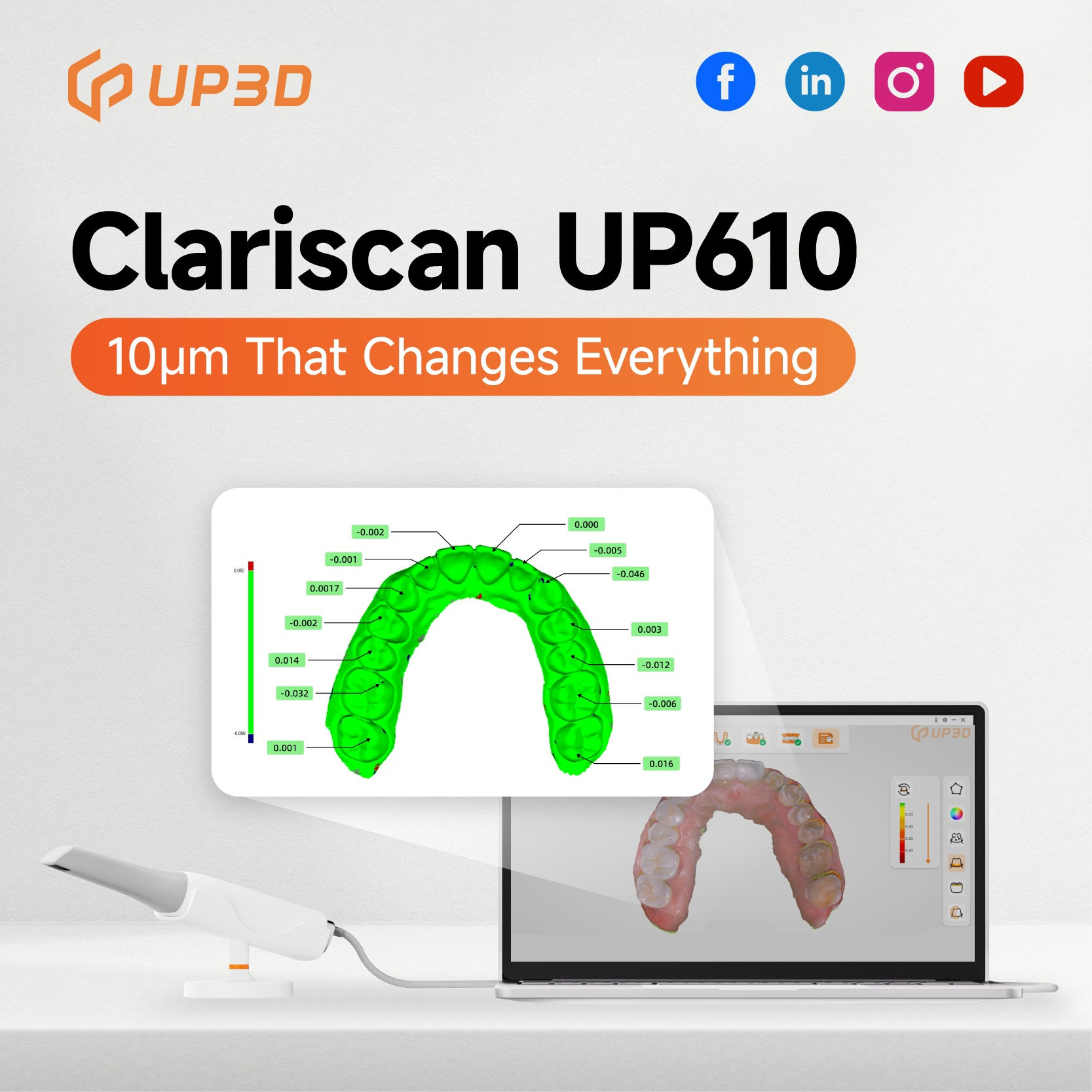 UP3D UP610 intraoral scanner showing 10μm accuracy in dental scan analysis