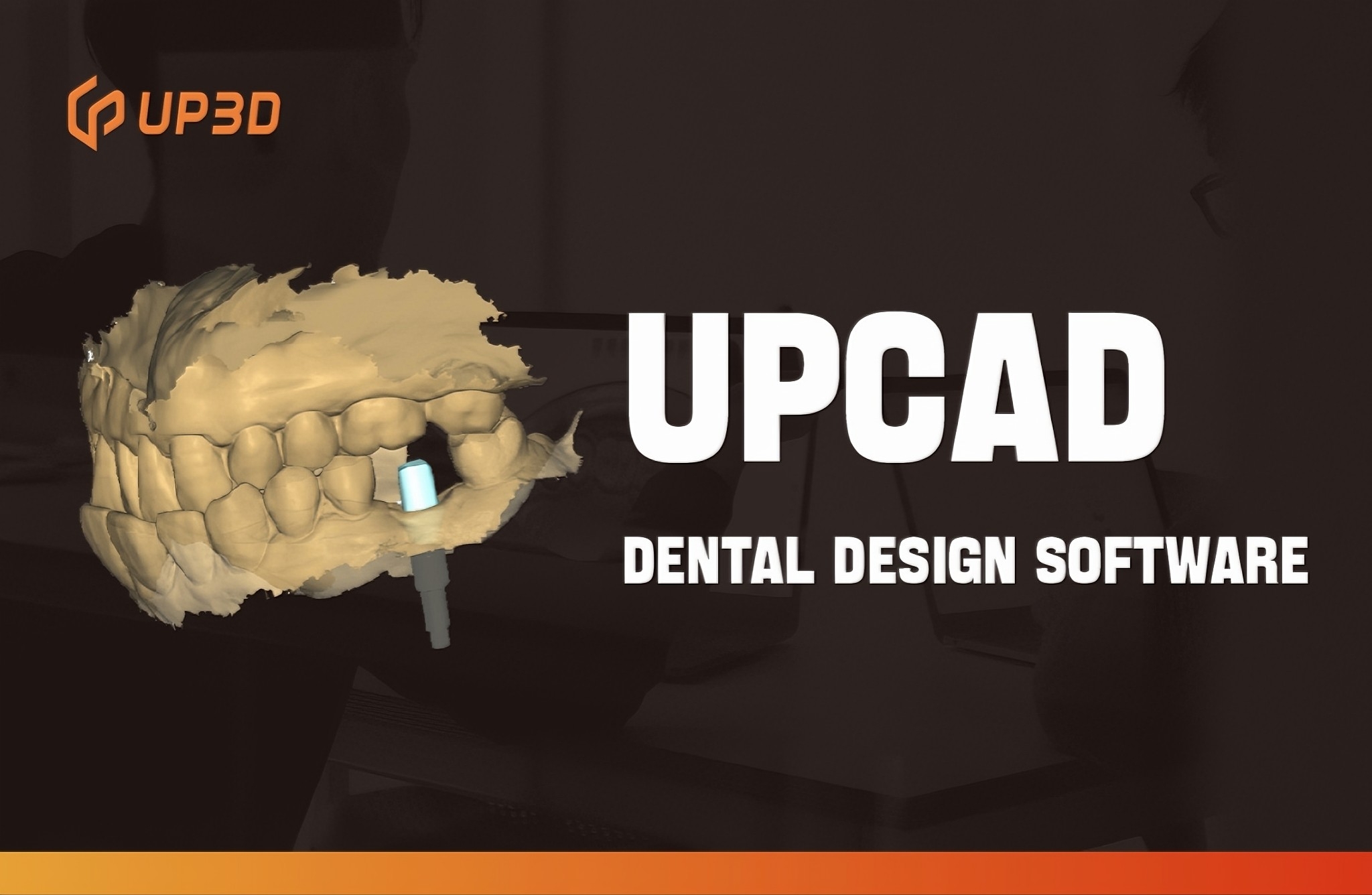 UPCAD dental design software showing digital 3D model of teeth and implant design