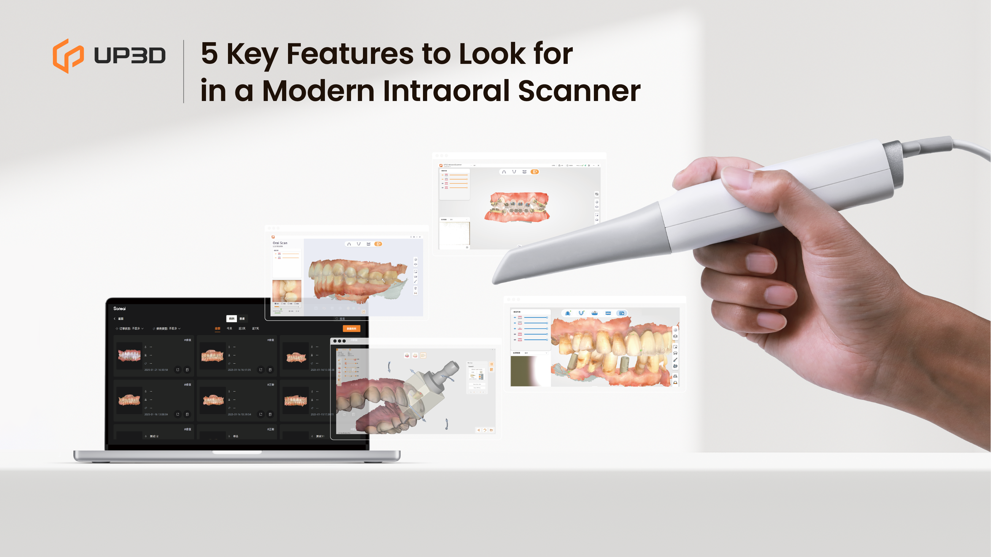 UP3D UP610 intraoral scanner connected to digital dentistry software, showing 3D tooth scans and modern CAD/CAM workflow.